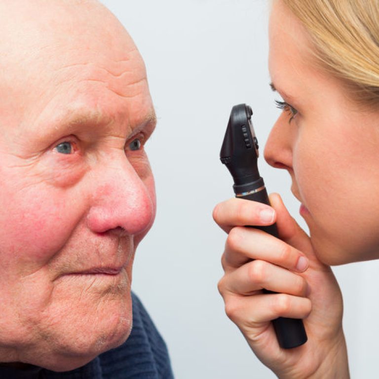 cataratta-vitamina-c