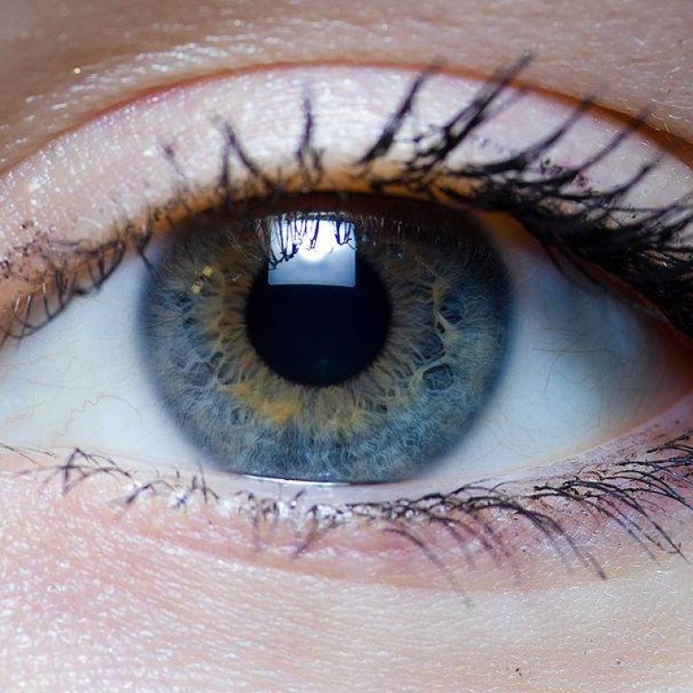 che-cos-la-neurite-ottica