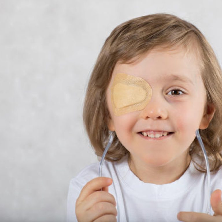 occhio-pigro-bambini